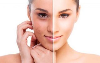 Los mejores tratamientos de medicina estética en Bogotá