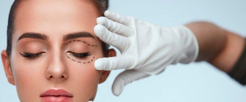 Cirugía de parpados