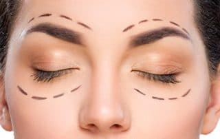 ¿Qué es la blefaroplastia y por qué es importante?