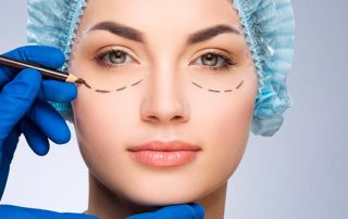 Recomendaciones postoperatorio de una cirugía de párpados