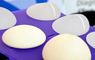 Prótesis anatómicas Vs. prótesis redondas