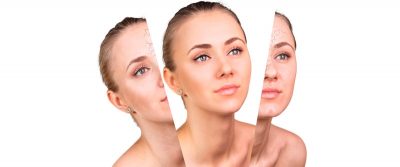 ¿Qué tener en cuenta antes de un rejuvenecimiento facial?