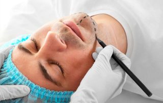 ¿Qué ocurre en un proceso de mentoplastia?