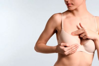 ¿Cuánto tiempo debe pasar antes del retoque de una mamoplastia de aumento?