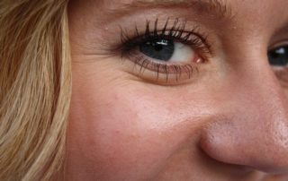 Arruguitas? Conoce qué es el rejuvenecimiento facial