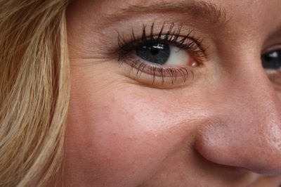 Arruguitas? Conoce qué es el rejuvenecimiento facial