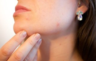 Riesgos de tratamientos faciales desde casa