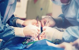 ¿Cómo se retiran los biopolímeros de los gluteos?
