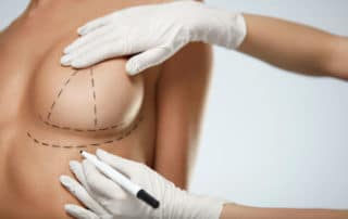 ¿Qué hacer en caso de dolores recurrentes tras una mamoplastia de aumento?