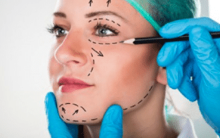 Corrección de una cirugía facial