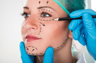 Corrección de una cirugía facial