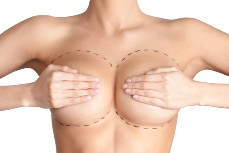 Pexia mamaria o elevación de senos