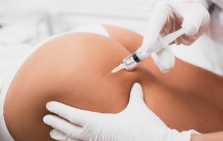 Evitar cicatrices en la extracción de biopolímeros