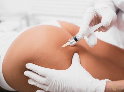 Evitar cicatrices en la extracción de biopolímeros