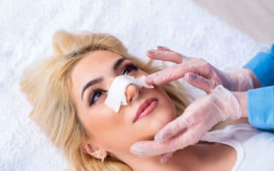 cuidados clave despues de una cirugia de nariz