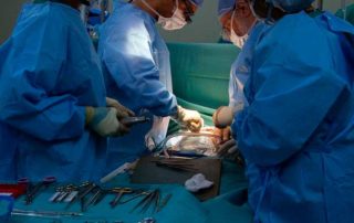 Tejidos maltratados a causa de los biopolímeros
