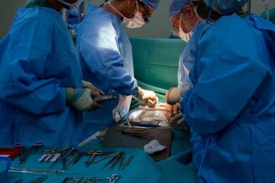 Tejidos maltratados a causa de los biopolímeros