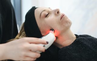 Terapia laser en la piel, una innovación que mejora vidas