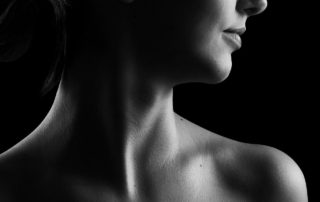 cervicoplastia o lifting cervical